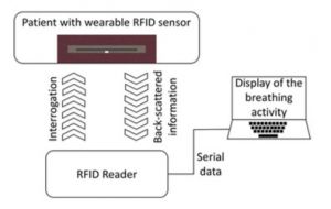 فن آوری RFID باند شکمی